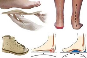 Orthopädische Schuhe für Hallux Valgus bei einem Kind