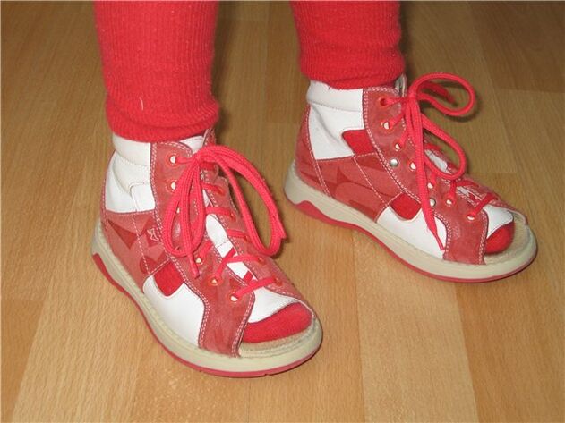 Schuhe für Kinder mit Hallux Valgus