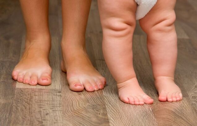 Verformung des Fußes bei Kindern